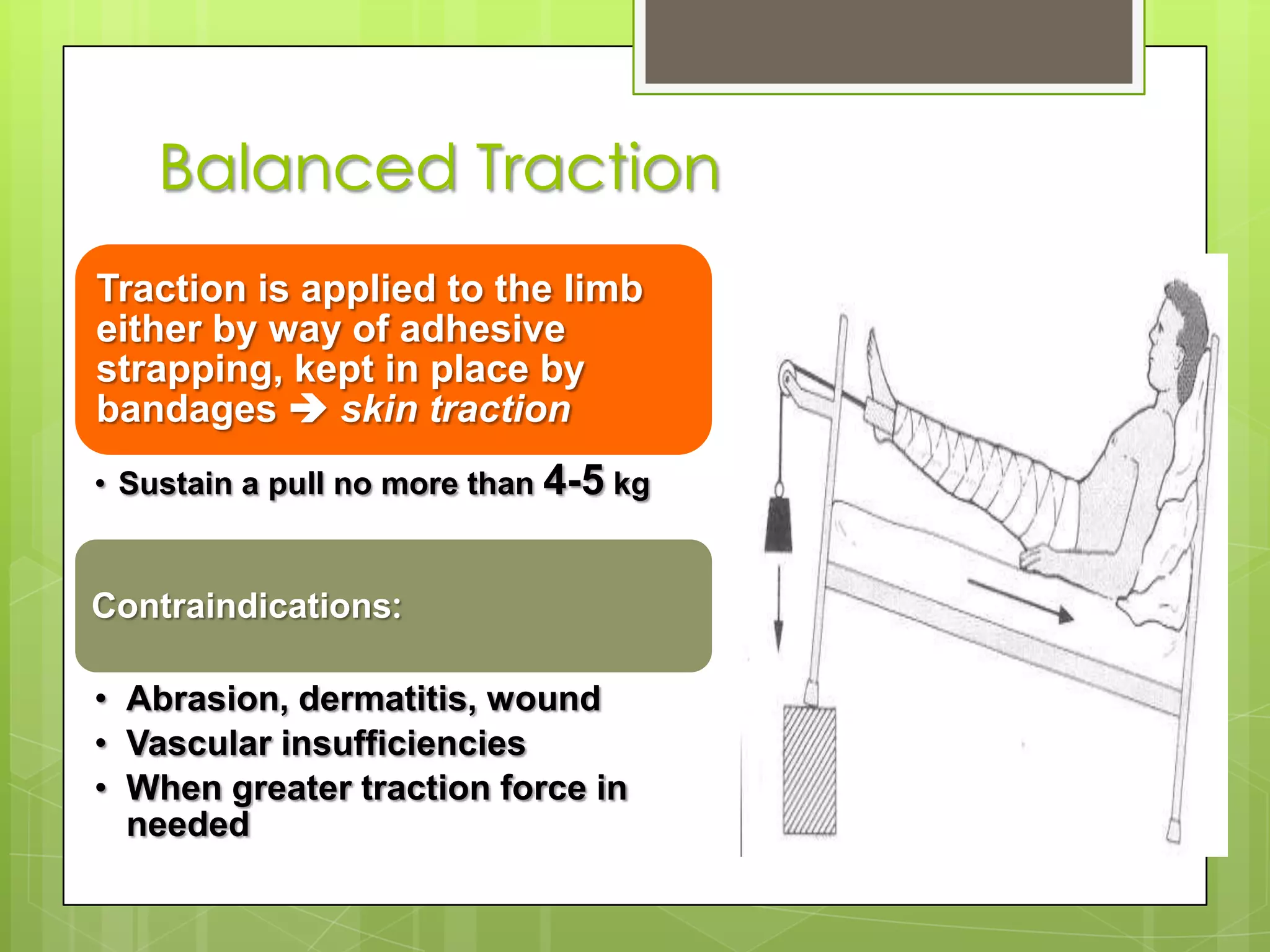 Forearm is supported in a wrist slingBalanced Traction