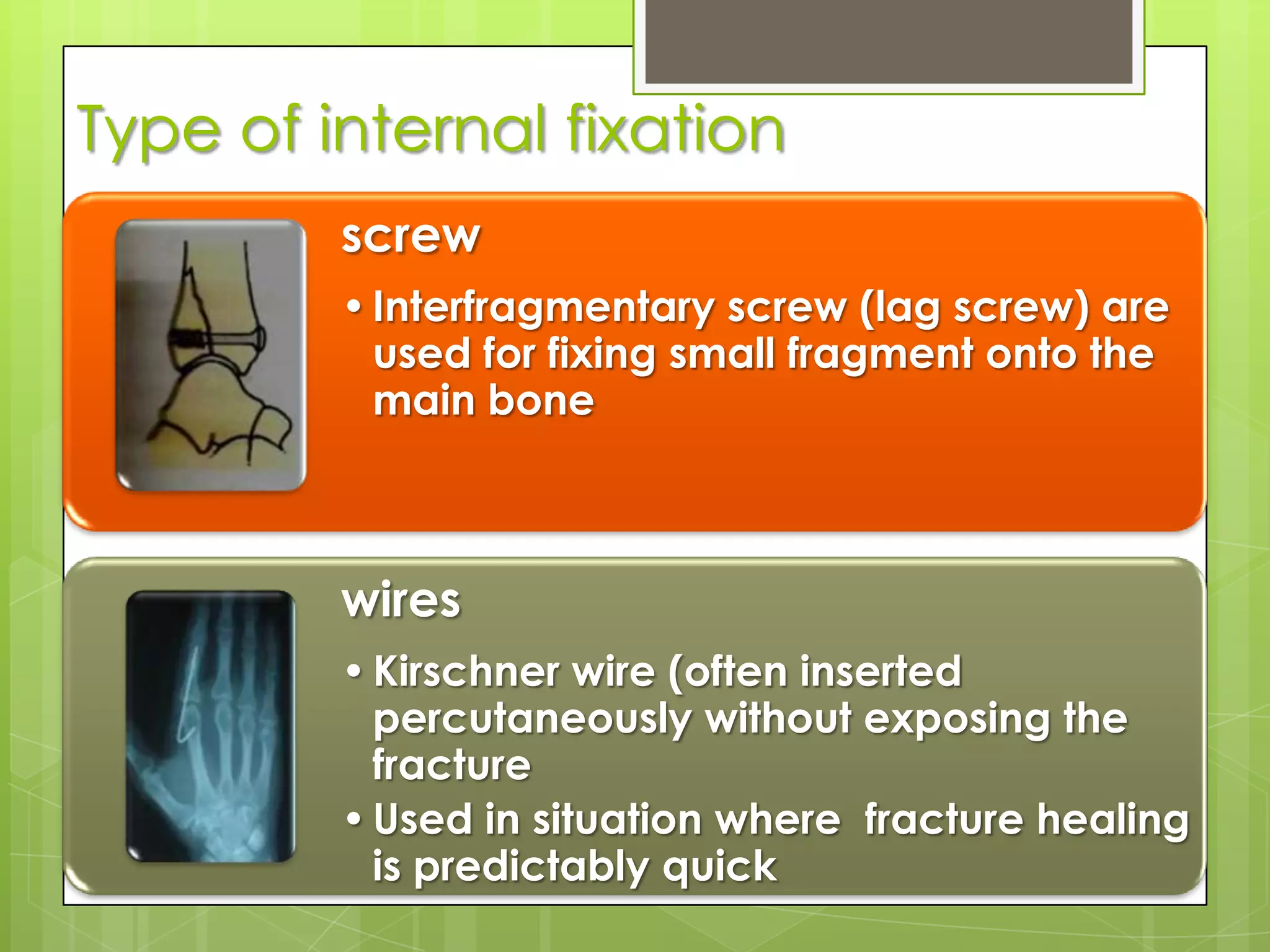 Type of internal fixation