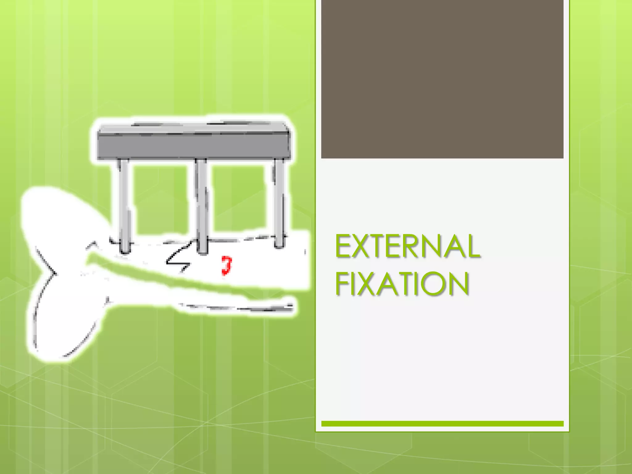 Pain at the site of fracture site is a danger signal.RefractureIt is important not to remove the metal implant too soon