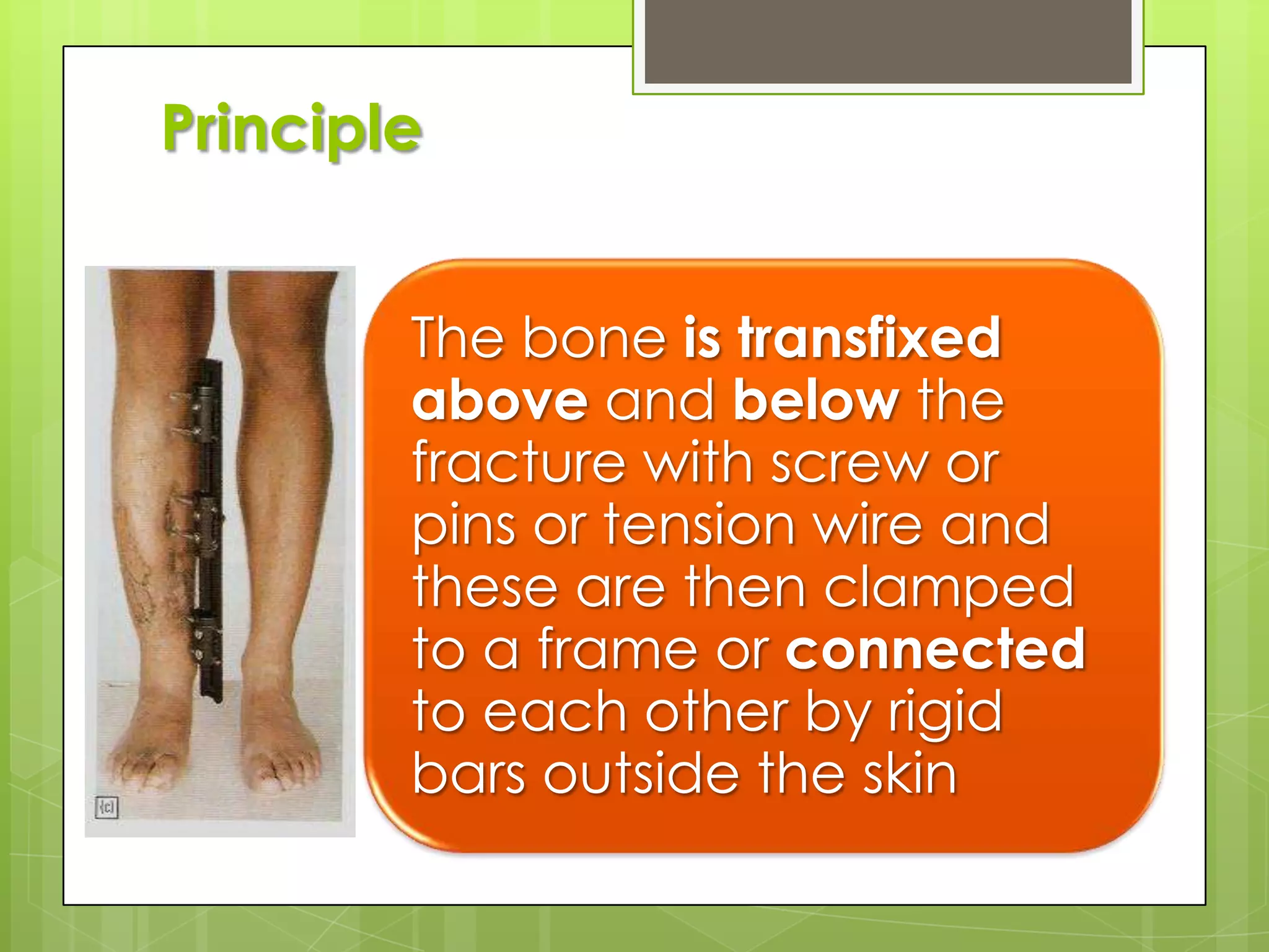 A year is minimum and 18 to 24 month is safer