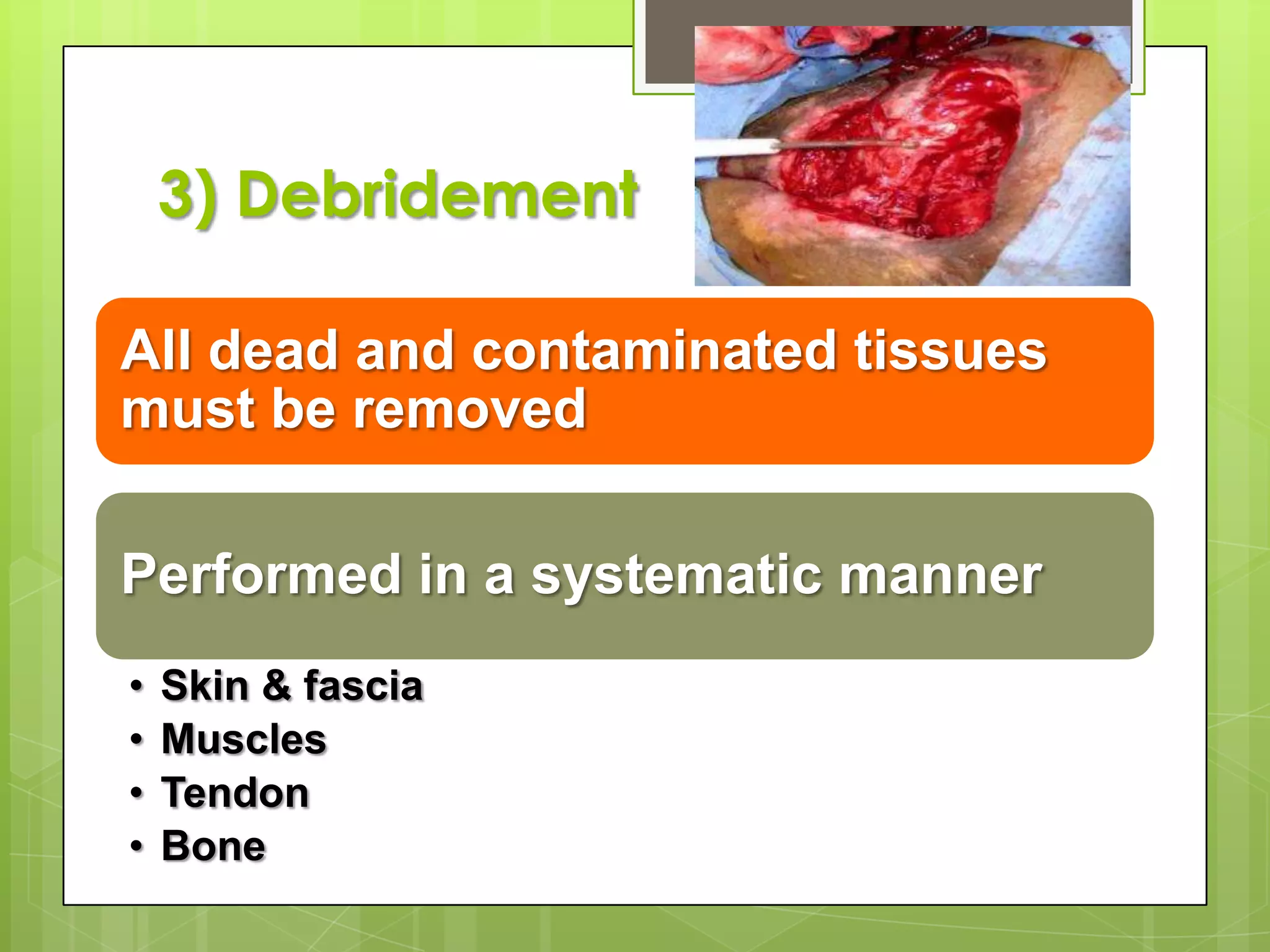 AntibioticGustiloGrade I- first generation of cephalosporin for 72 hours