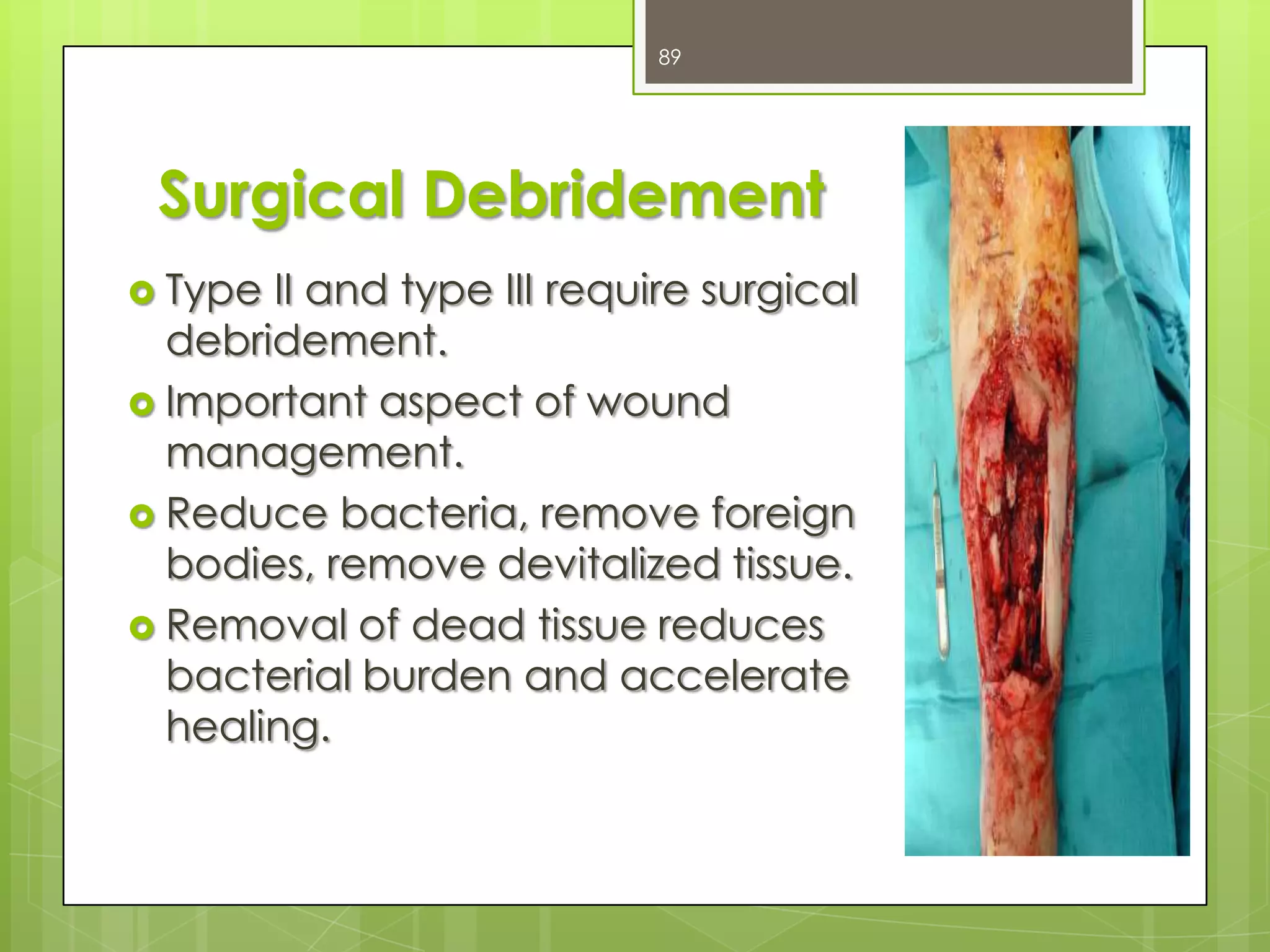 Gustilo Grade II- first generation cephalosporin for 72 hours + Gram negative coverage (gentamicin) for at least 72 hours