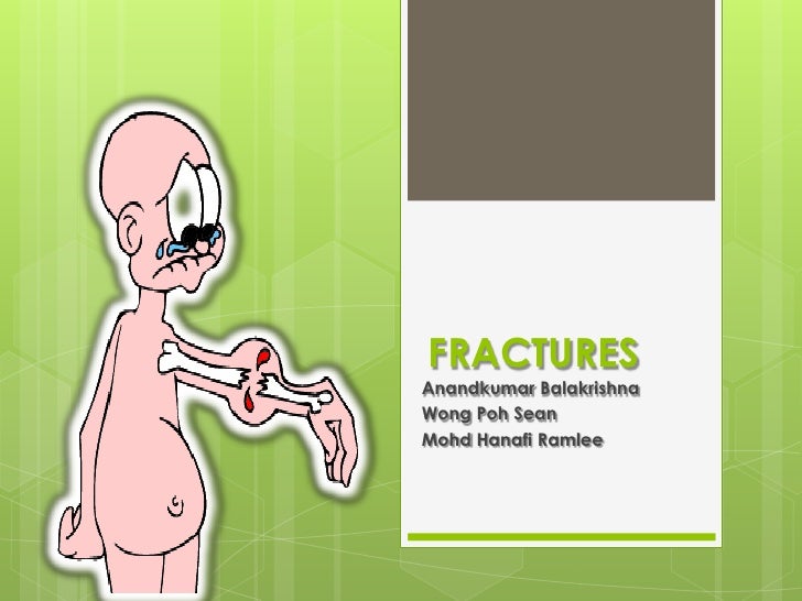 OPEN FRACTURE #1