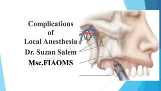 Complication of local anesthesia Dr. suzan salem