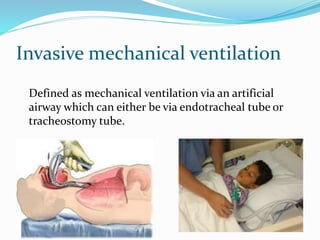 Invasive mechanical ventilation
Defined as mechanical ventilation via an artificial
airway which can either be via endotracheal tube or
tracheostomy tube.
 