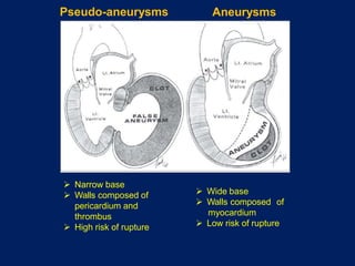 Complication of MI.pptx