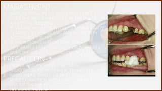 Complication of Tooth Extraction and their Management | PPTX