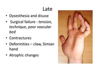 Complications in nerve surgery | PPT