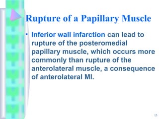 Rupture of a Papillary Muscle
• Inferior wall infarction can lead to
rupture of the posteromedial
papillary muscle, which occurs more
commonly than rupture of the
anterolateral muscle, a consequence
of anterolateral MI.
15
 