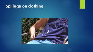 Spillage on clothing
 