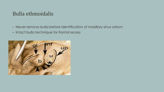 Bulla ethmoidalis
• Never remove bulla before identification of maxillary sinus ostium
• Intact bulla technique for frontal recess
 