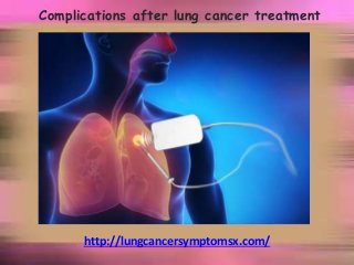 Complications after lung cancer treatment
http://lungcancersymptomsx.com/
 