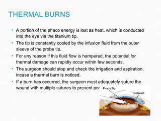 A portion of the phaco energy is lost as heat, which is conducted into the eye via the titanium tip. The tip is constantly cooled by the infusion fluid from the outer sleeve of the probe tip. For any reason if this fluid flow is hampered, the potential for thermal damage can rapidly occur within few seconds. The surgeon should stop and check the irrigation and aspiration, incase a thermal burn is noticed. If a burn has occurred, the surgeon must adequately suture the wound with multiple sutures to prevent post operative leak. http://adrianhoe.com/adrianhoe/images/blog/phaco_lateral.jpg 
