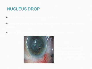 Hard  nucleus  is seen  dropping to right after  posterior capsule rupture www.osnsupersite.com/images This is another major complication of phaco. During the process the nucleus drops through capsular tear into the  vitreous. This can lead to complications like uveitis, retinal detachment etc. 