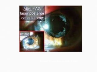 SOURCE:laserengraver.com 