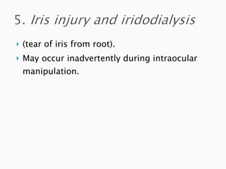 (tear of iris from root). May occur inadvertently during intraocular manipulation. 