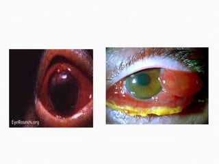 webeye.ophth.uiowa.edu  ophthalmicphotography.info  