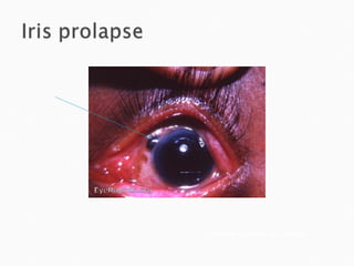 webeye.ophth.uiowa.edu 