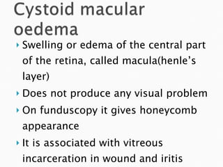 Swelling or edema of the central part of the retina, called macula(henle’s layer) Does not prod uce any visual problem On funduscopy it gives honeycomb appearance It is associated with vitreous incarceration in wound and iritis 