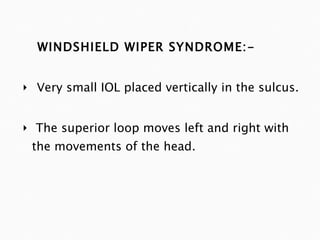 WINDSHIELD WIPER SYNDROME:- Very small IOL placed vertically in the sulcus. The superior loop moves left and right with the movements of the head. 