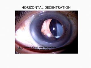HORIZONTAL DECENTRATION flylib.com 
