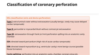 Ellis Classification Types Complications of Coronary angiography and PCI.pptx