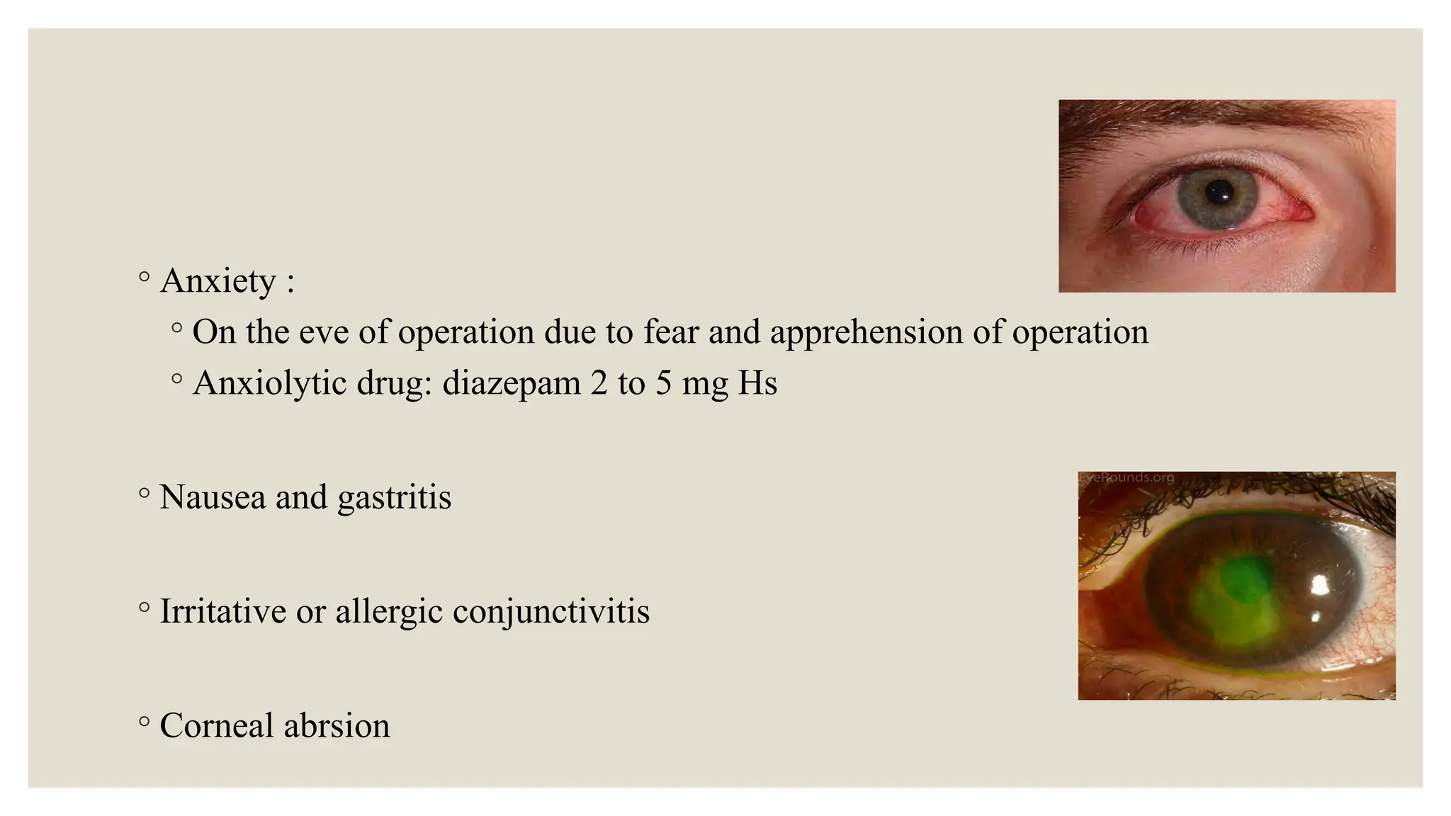 ◦ Anxiety :
◦ On the eve of operation due to fear and apprehension of operation
◦ Anxiolytic drug: diazepam 2 to 5 mg Hs
◦ Nausea and gastritis
◦ Irritative or allergic conjunctivitis
◦ Corneal abrsion
 