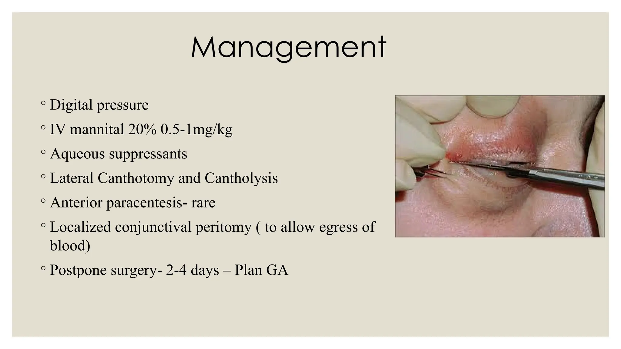 Management
◦ Digital pressure
◦ IV mannital 20% 0.5-1mg/kg
◦ Aqueous suppressants
◦ Lateral Canthotomy and Cantholysis
◦ Anterior paracentesis- rare
◦ Localized conjunctival peritomy ( to allow egress of
blood)
◦ Postpone surgery- 2-4 days – Plan GA
 