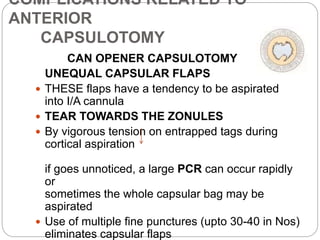 Capsular Defect Closure Complications of cataract surgery | PPTX