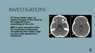 Delta Sign Mri Complications of com | PPTX