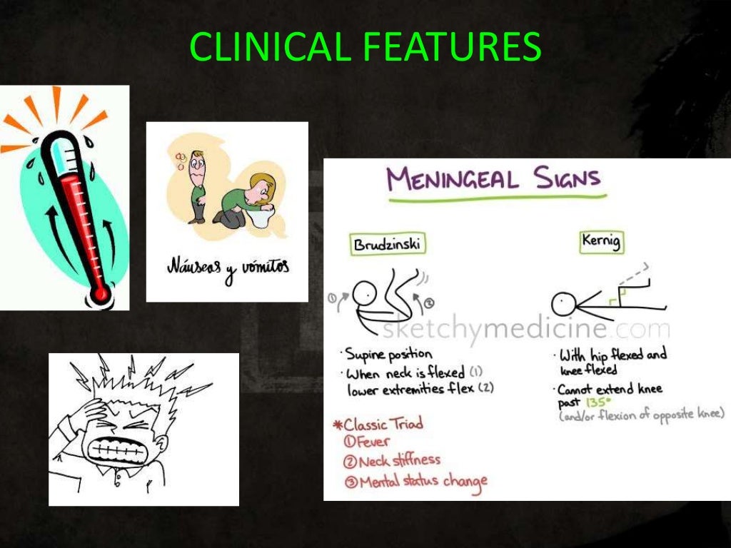 complications-of-csom