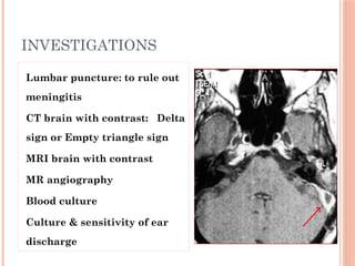Delta Sign Mri complicationsofcsom-160619105421.pptxgfh | PPTX