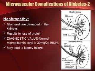 Complications Of Diabetes | PPT