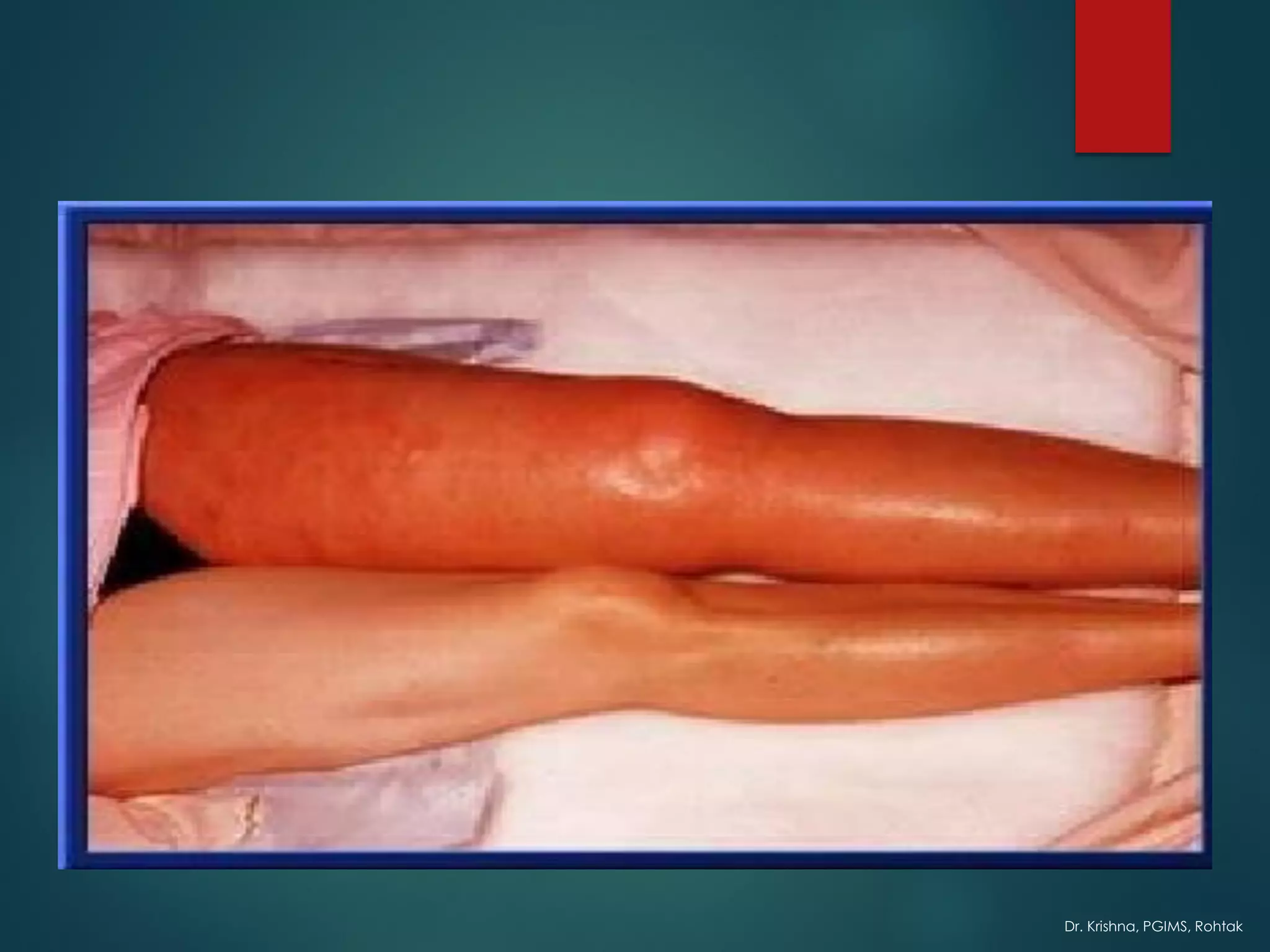 Dr. Krishna, PGIMS, Rohtak
 