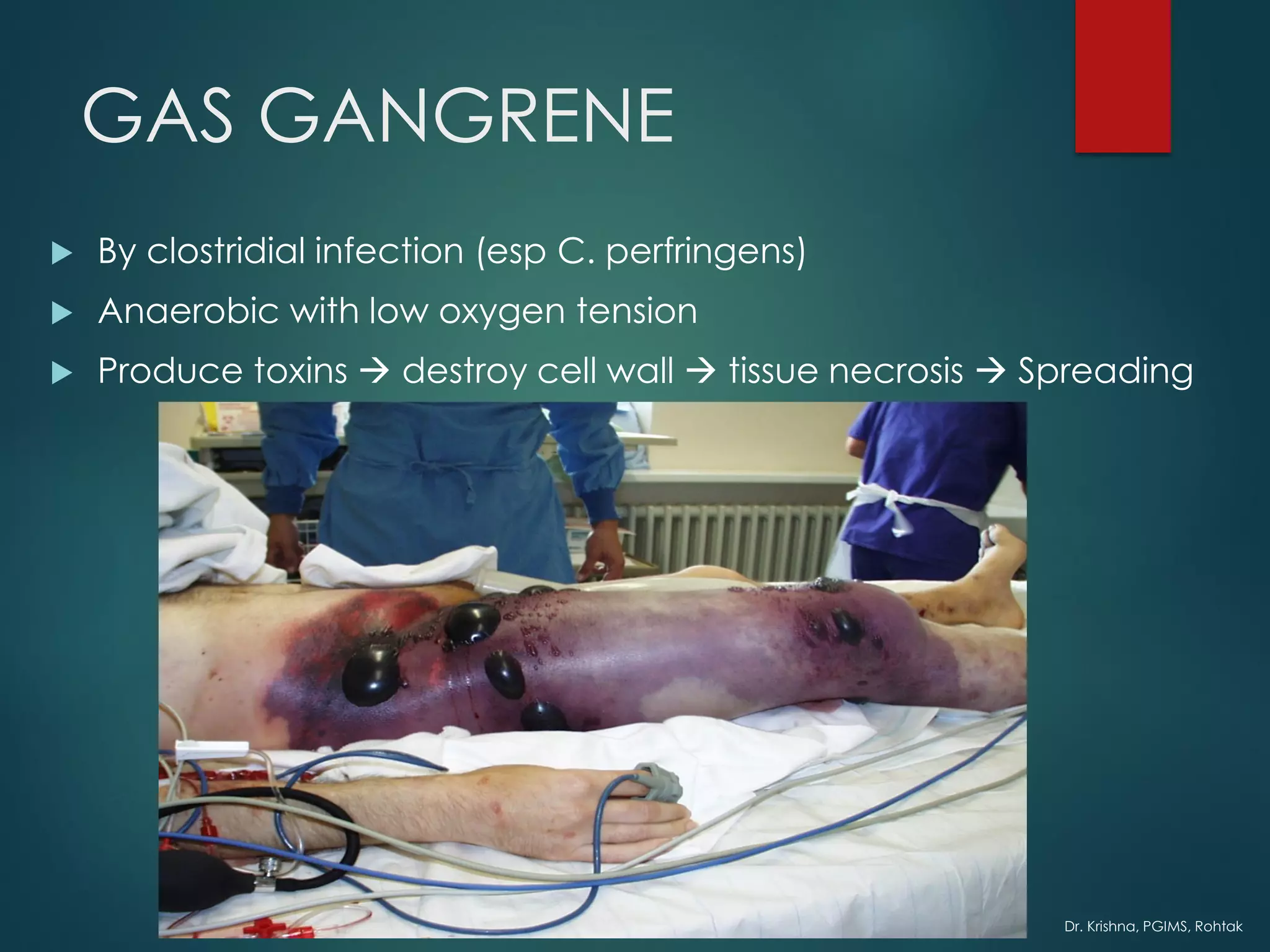 Dr. Krishna, PGIMS, Rohtak
GAS GANGRENE
 By clostridial infection (esp C. perfringens)
 Anaerobic with low oxygen tension
 Produce toxins → destroy cell wall → tissue necrosis → Spreading
 