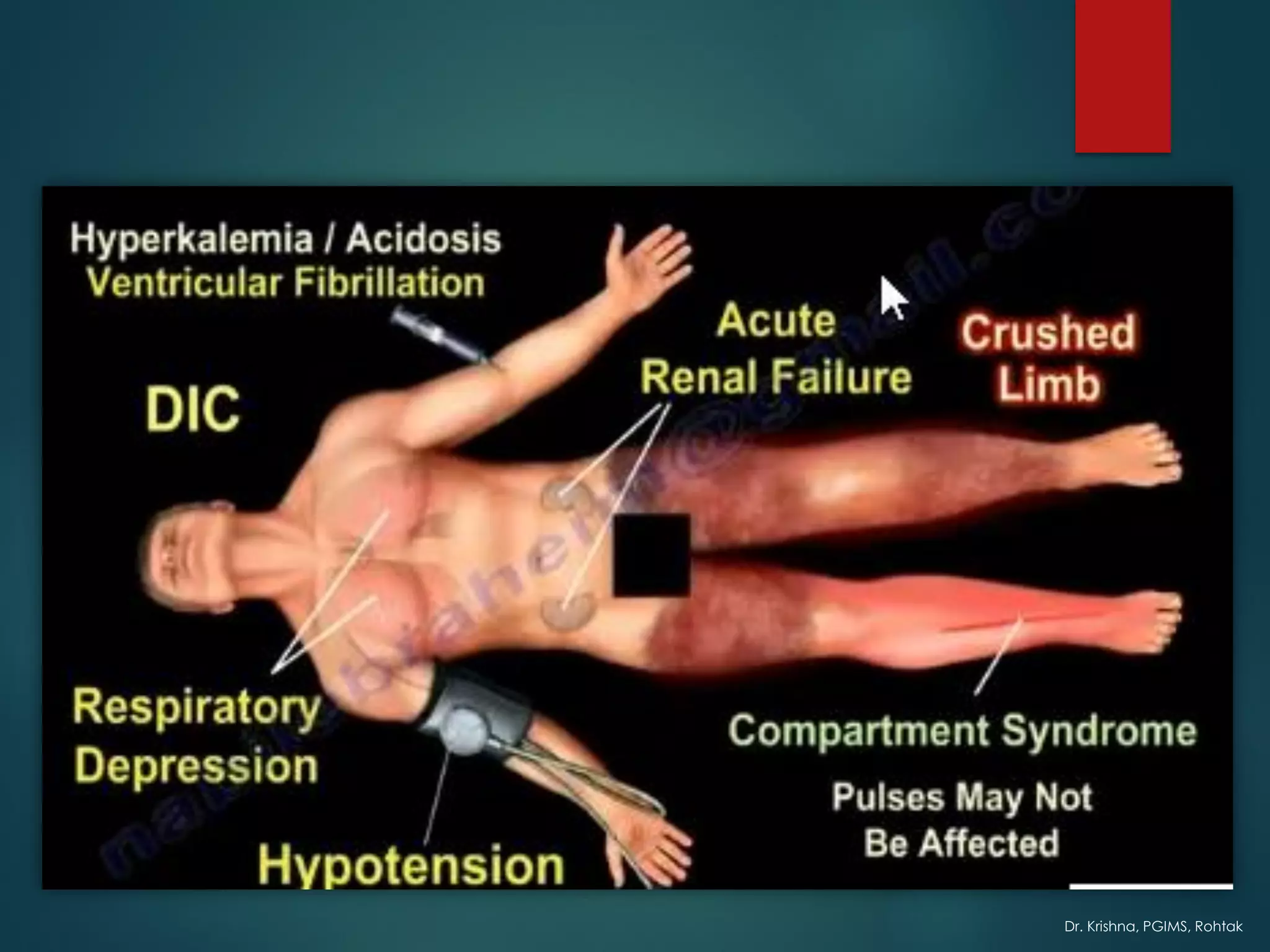 Dr. Krishna, PGIMS, Rohtak
 