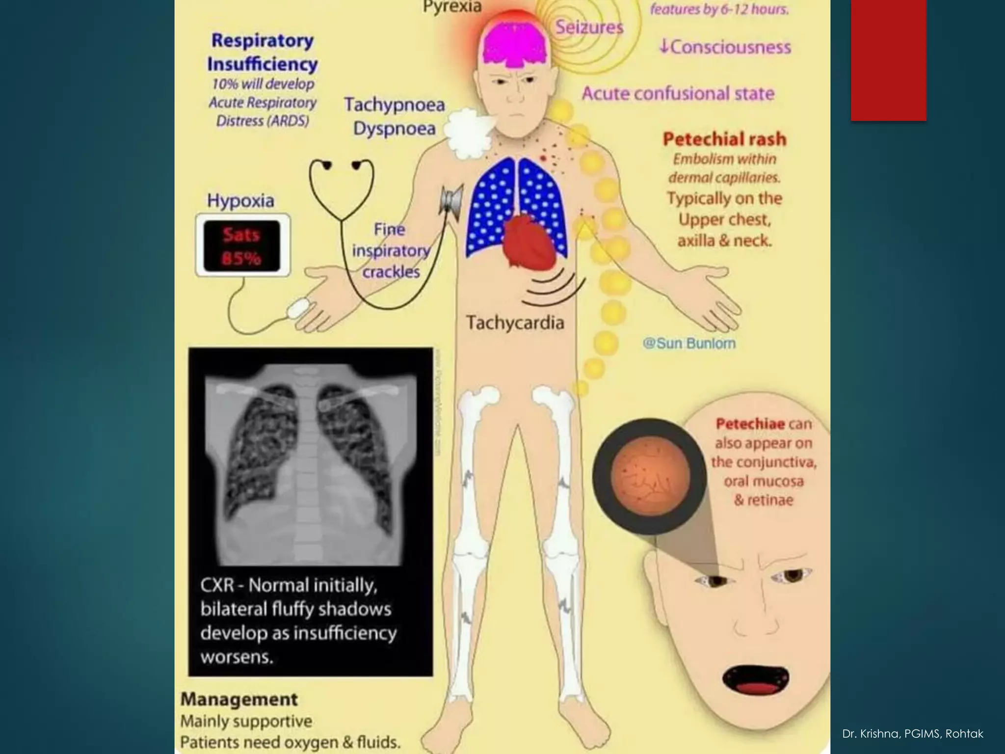 Dr. Krishna, PGIMS, Rohtak
 