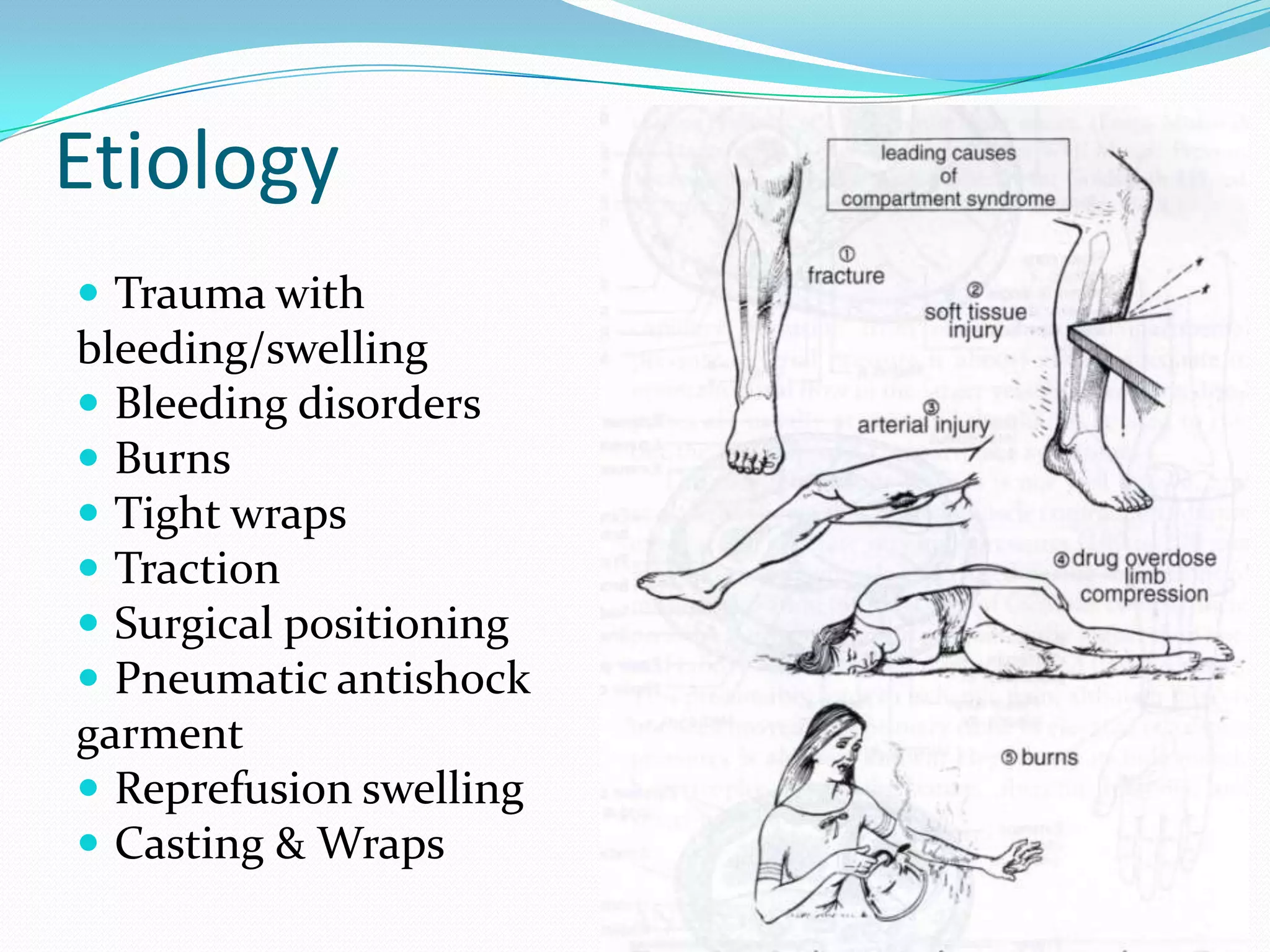 Etiology
 Trauma with
bleeding/swelling
 Bleeding disorders
 Burns
 Tight wraps
 Traction
 Surgical positioning
 Pneumatic antishock
garment
 Reprefusion swelling
 Casting & Wraps
 