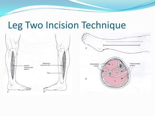 Leg Incision Types Complications of fractures | PPTX