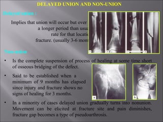 Complications of fractures 3.pptnew | PPT