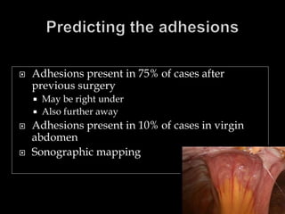 Complications of laparoscopy | PPTX