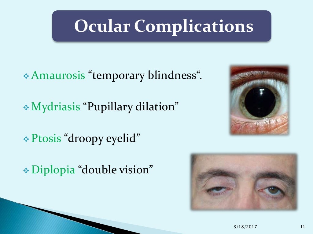 Complications of Local Anesthesia