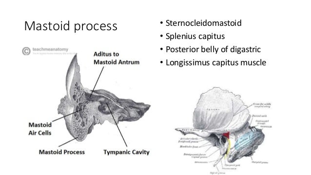 complications of mastoiditis complications of mastoiditis, Skeleton