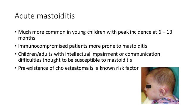 complications of mastoiditis complications of mastoiditis, Skeleton