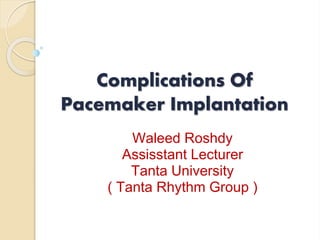 Complications Of
Pacemaker Implantation
Waleed Roshdy
Assisstant Lecturer
Tanta University
( Tanta Rhythm Group )
 