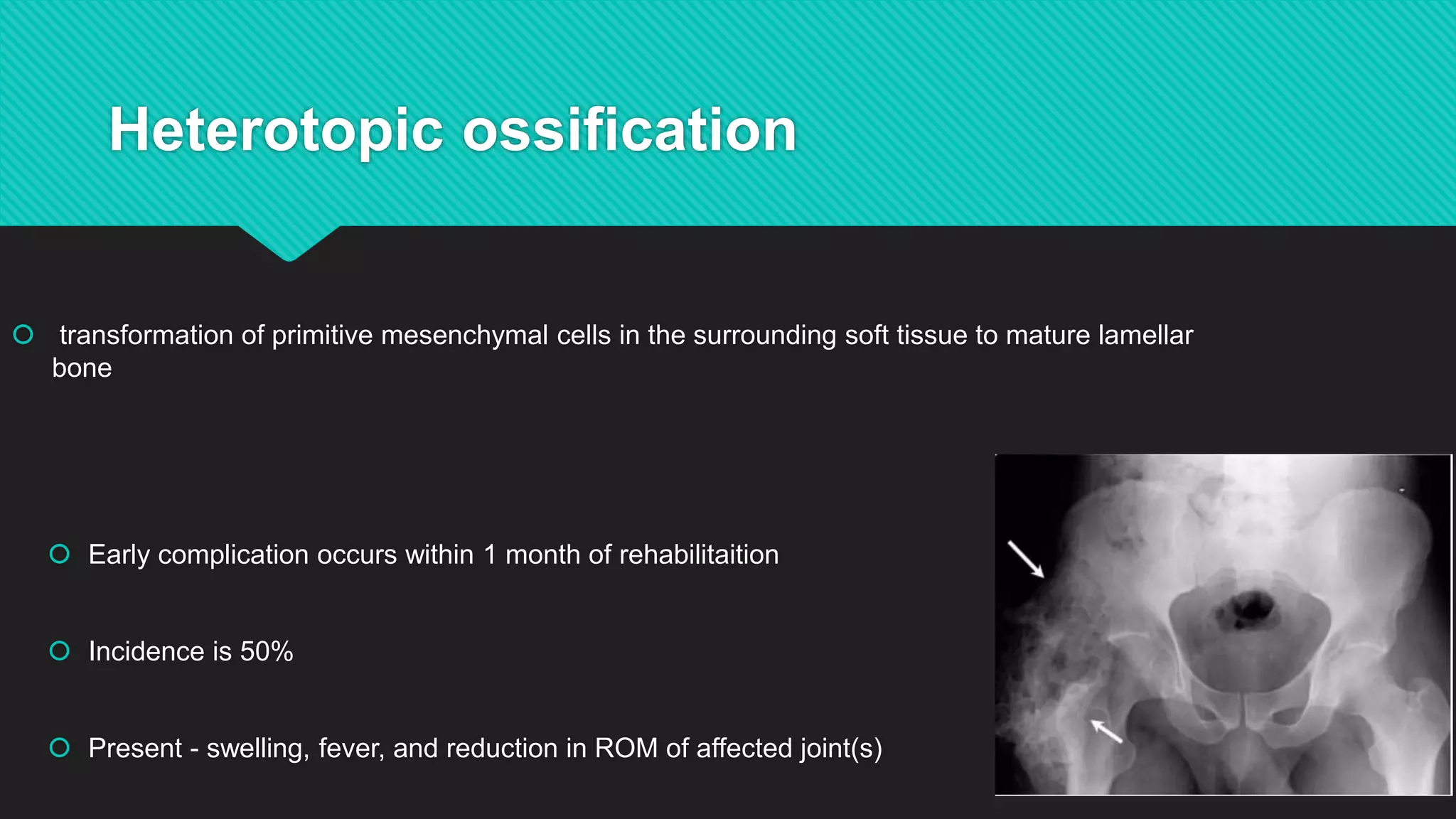Heterotopic ossification
 transformation of primitive mesenchymal cells in the surrounding soft tissue to mature lamellar
bone
 Early complication occurs within 1 month of rehabilitaition
 Incidence is 50%
 Present - swelling, fever, and reduction in ROM of affected joint(s)
 