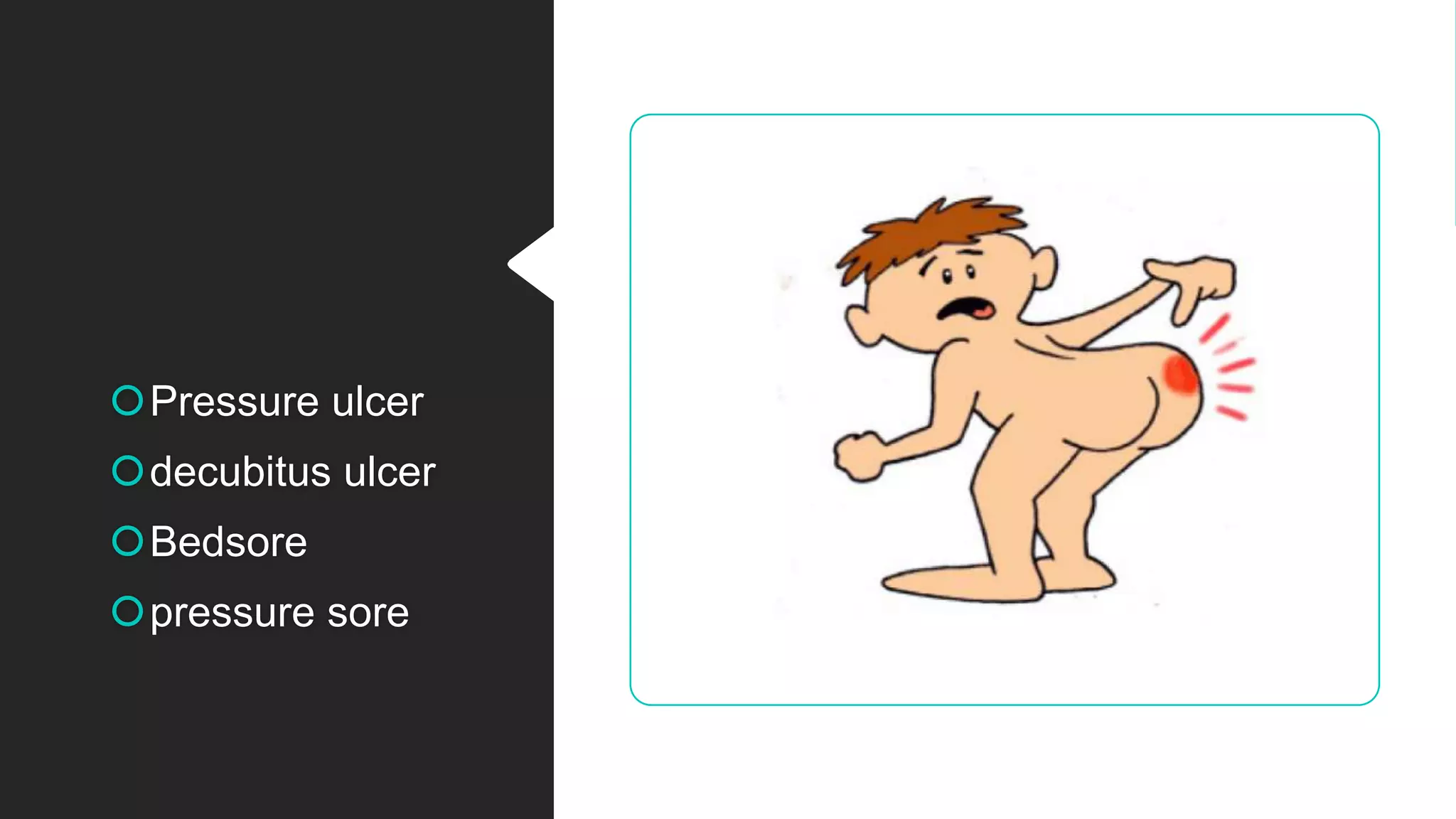 Pressure ulcer
decubitus ulcer
Bedsore
pressure sore
 
