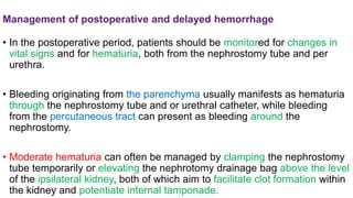 COMPLICATIONS OF PCNL.pptx