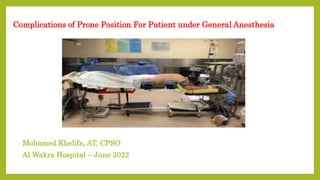 Complications of Prone Position For Patient under General Anesthesia
Mohamed Khelifa, AT, CPSO
Al Wakra Hospital – June 2022
 