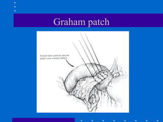 Graham patch
 